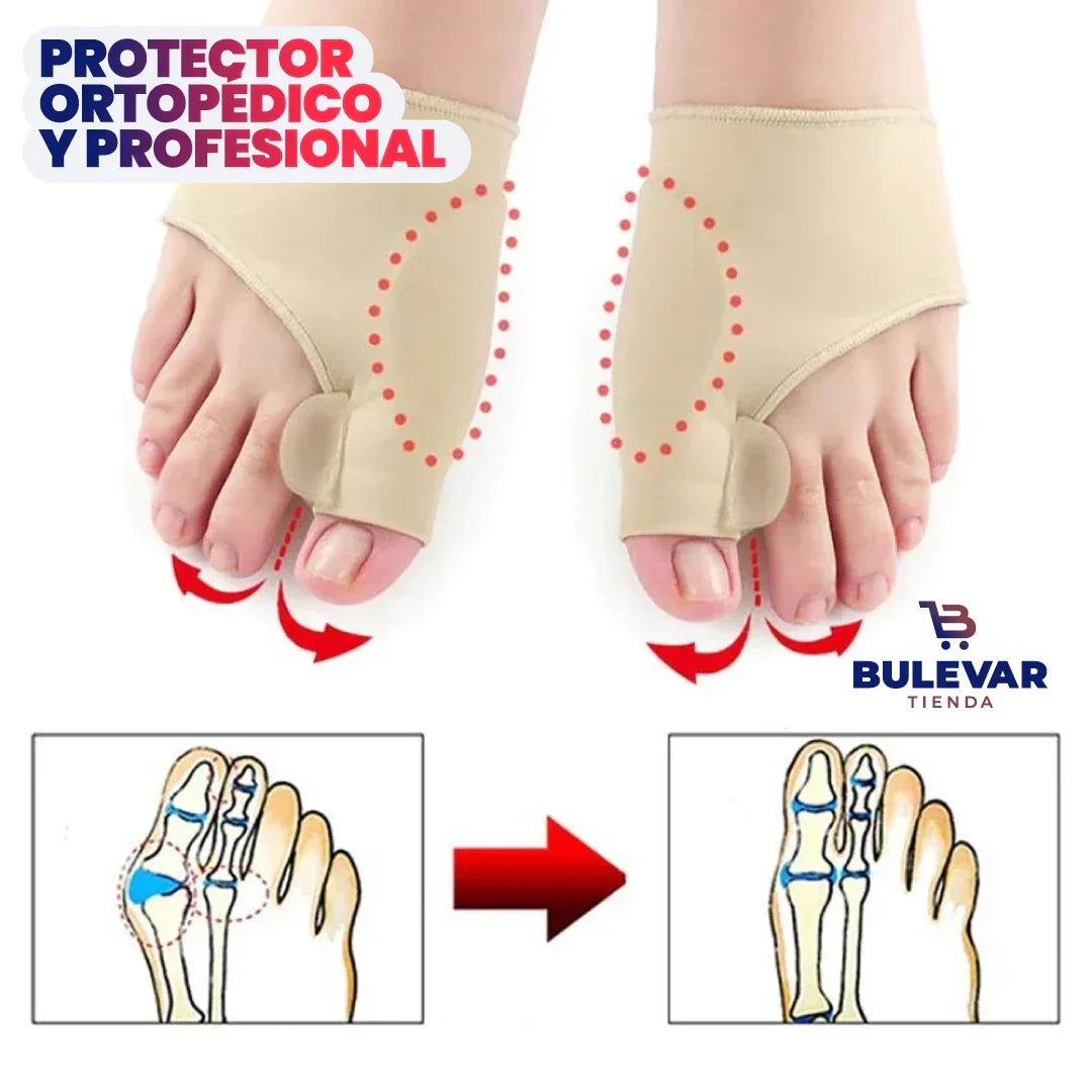 Par de Corrector de juanetes